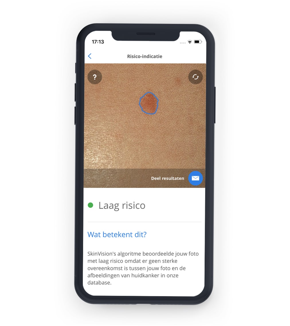 Telefoon met huid scan van de SkinVision app